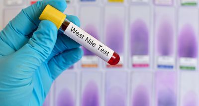 West Nile Virus diagnosed in the UK
